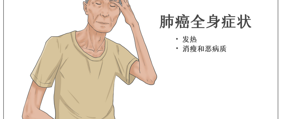 摄图网_401802923_wx_肺癌全身症状医疗插画（企业商用） (1).jpg